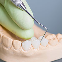 Dental model of smile with fixed bridge restoration