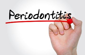 A sign that says, "Periodontitis"