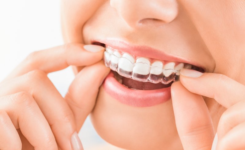 Woman putting on Invisalign clear aligner