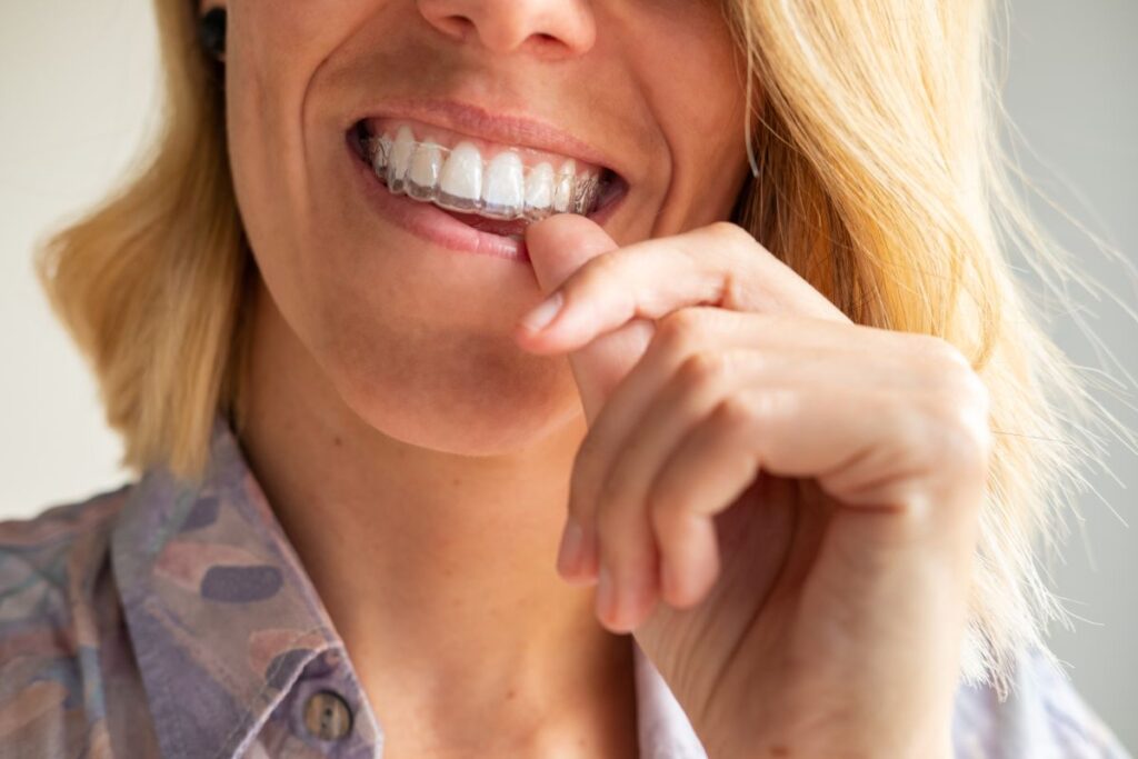 A woman putting on a ClearCorrect aligner